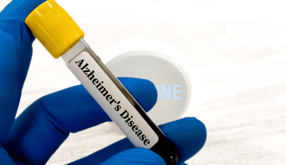 Thumbnail for Russia releases National Healthcare Guidelines featuring AI integration in medical diagnostics