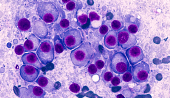 Thumbnail for Egypt’s Al Mokhtabar installs fully automated Sysmex blood science track line