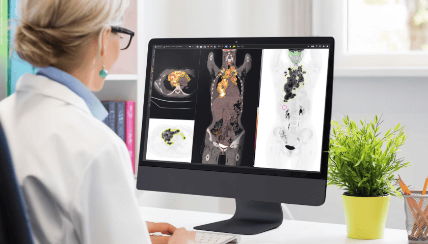 Thumbnail for GE HealthCare leverages MIM software to advance personalized oncology with Mayo Clinic