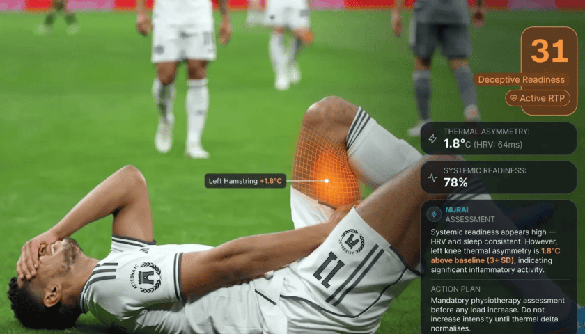 Thumbnail for Amplifai Health launches AI Thermal Platform NUR to transform sports recovery analytics