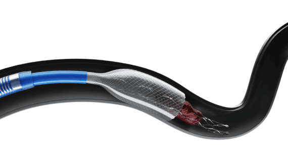 Thumbnail for Revvity launches CE-IVDR Type 1 diabetes screening kit in Europe for children